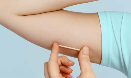 Lages passa a ofertar novo método contraceptivo subdérmico na rede municipal de saúde